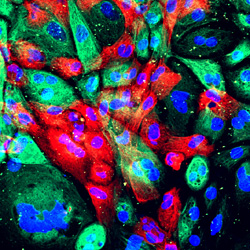 Xenograft model of prostate cancer